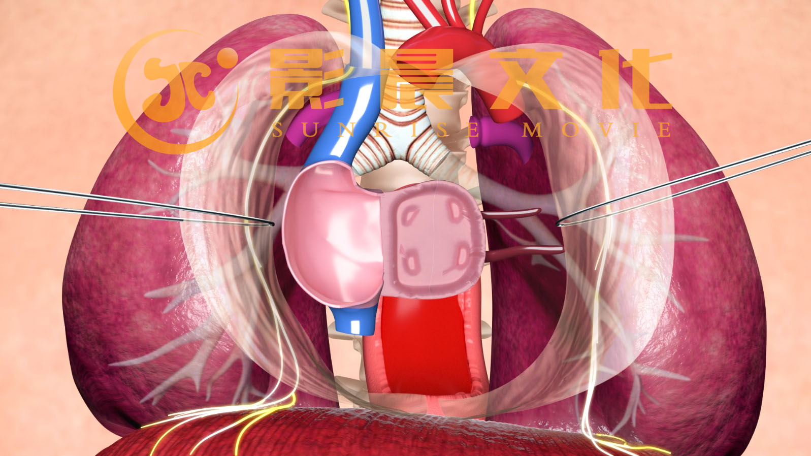 醫(yī)學(xué)三維動(dòng)畫