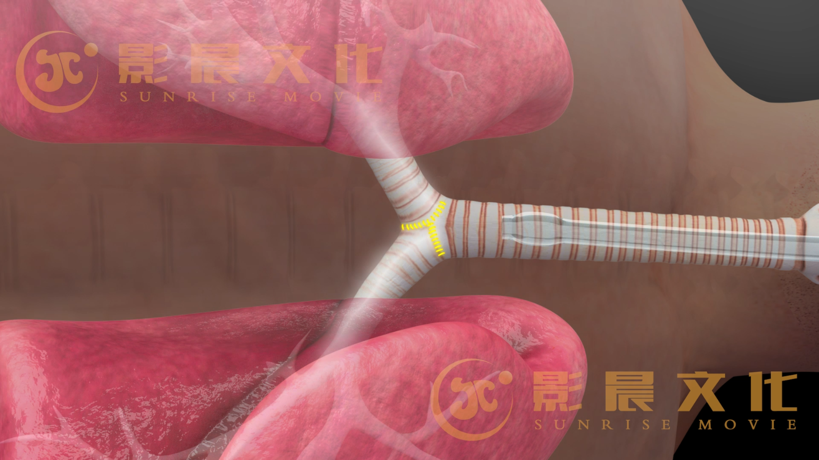 醫(yī)學(xué)三維動(dòng)畫