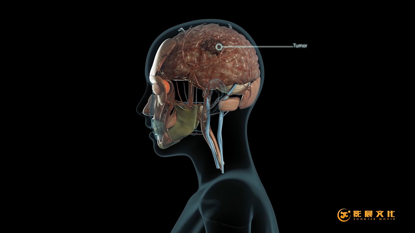 專業(yè)的廣州醫(yī)學(xué)三維動(dòng)畫制作公司，廣州醫(yī)學(xué)三維動(dòng)畫案例