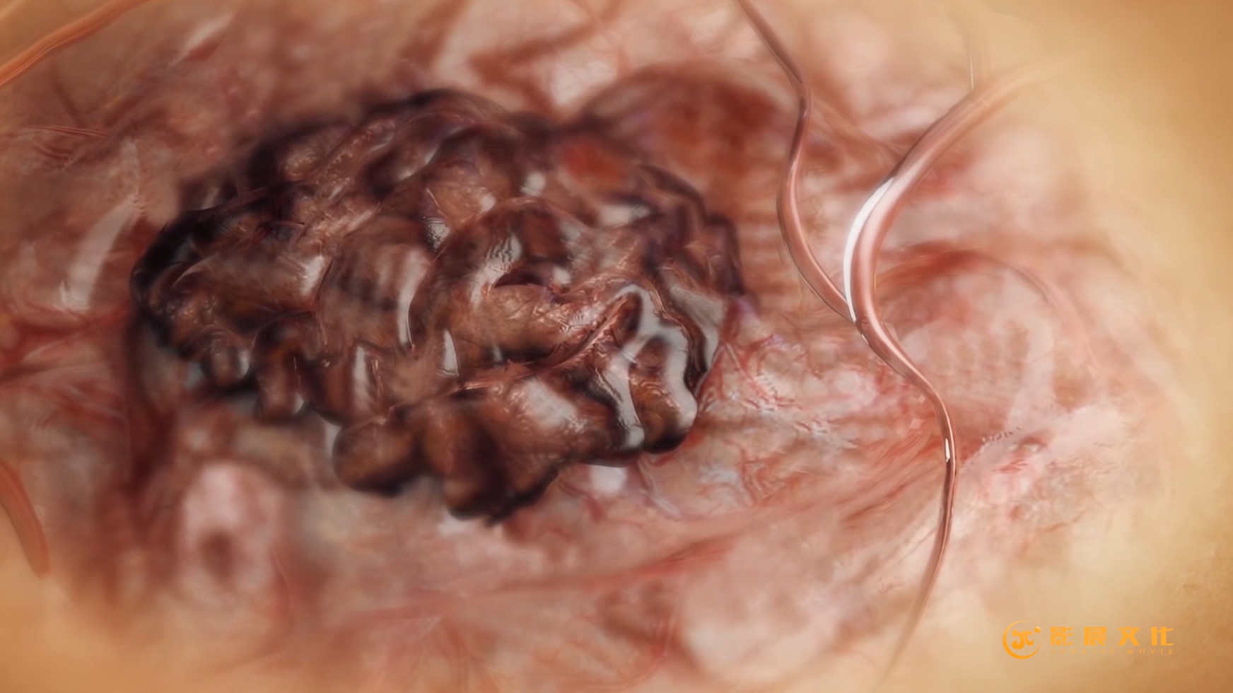 廣州醫(yī)學三維動畫宣傳片