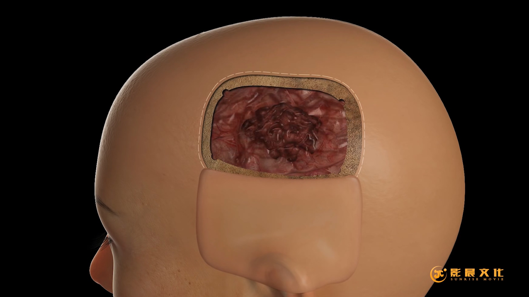 廣州醫(yī)學(xué)三維動畫