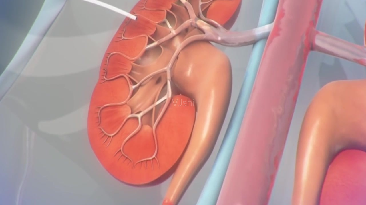 廣州醫(yī)療三維動畫制作的價值家屬能夠直觀地了解病理學(xué)